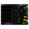 Monitor GIMA BM3 - ECG + SPO2 + NIBP + RESP + TEMP