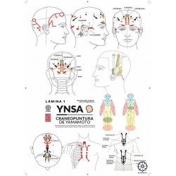 Yamamoto Lam1 Yamamoto's YNSA Craniopuncture Lam1