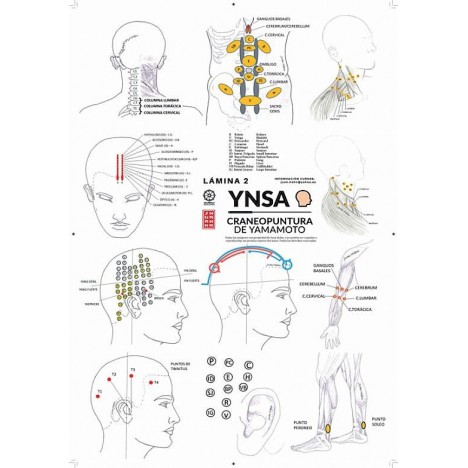 Lámina YINSA Craneopuntura de Yamamoto Lam2