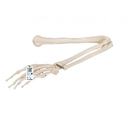 Esqueleto del Brazo - 3B Smart Anatomy
