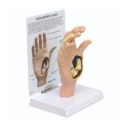 Modèle de main arthrosique