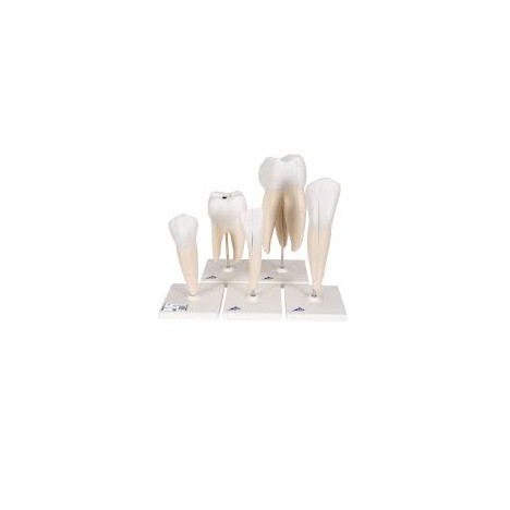 Série de modèles dentaires, 5 modèles - 3B Smart Anatomy