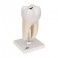 Molar inferior con 2 raíces - 3B Smart Anatomy