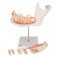 Afección dental, a 2 aumentos, de 21 piezas - 3B Smart Anatomy
