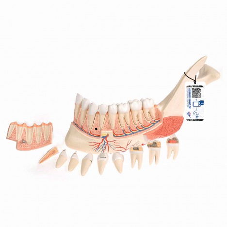 Mitad de la mandíbula inferior con 8 dientes cariados, 19 piezas - 3B Smart Anatomy