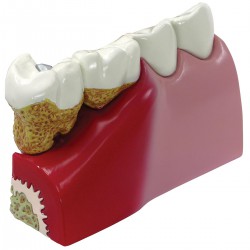 Modelo de dientes