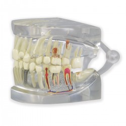 Modelo de mandíbula humana transparente con dientes