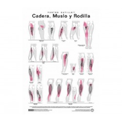 Lamina Puntos Gatillo - Cadera, Muslo y Rodilla