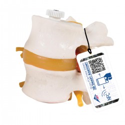 Disques lombaires, avec hernie discale. Flexible monté sur support - 3B Smart Anatomy