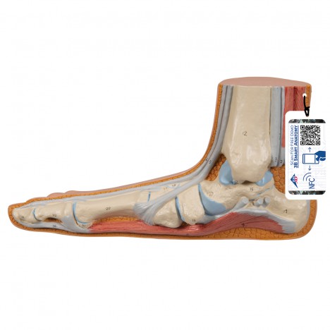 Modèle de pied plat (Pes Planus) - 3B Smart Anatomy