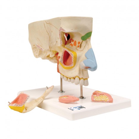 Nez avec les cavités paranasales, divisé en 5 parties - 3B Smart Anatomy