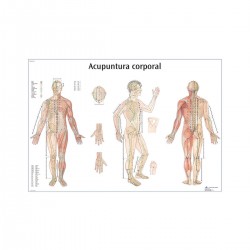 Acupuncture corporelle
