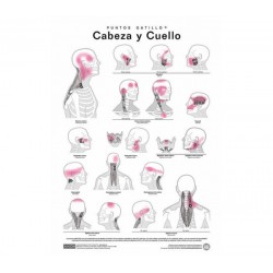 Lamina Puntos Gatillo - Cabeza y cuello