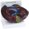 Modelo de hígado/vesícula biliar con cálculos biliares