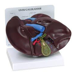Modelo de hígado/vesícula biliar con cálculos biliares