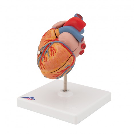 Cœur classique avec hypertrophie ventriculaire gauche (HVG), 2 pièces - 3B Smart Anatomy