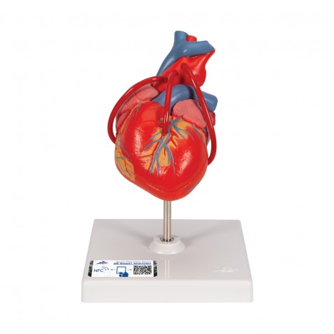 Corazón clásico con bypass, de 2 piezas - 3B Smart Anatomy