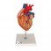 Corazón con bypass, 2 veces el tamaño natural, de 4 piezas - 3B Smart Anatomy