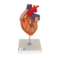 Corazón con bypass, 2 veces el tamaño natural, de 4 piezas - 3B Smart Anatomy