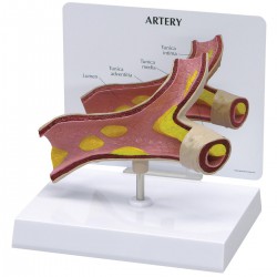 Modelo de arteria