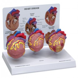 Conjunto de tres modelos de corazón tamaño reducidoConjunto de tres modelos de corazón tamaño reducido