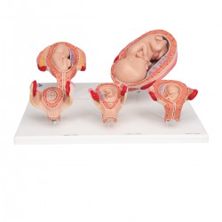 3B Scientific® Pregnancy Series, 5 modèles
