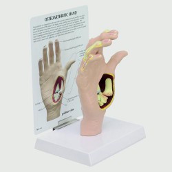 Modelo de mano con osteoartritis