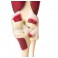 Articulación de la rodilla, tamaño natural, con músculos