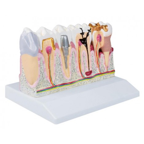 Modelo dental, 4 veces el tamaño natural - EZ Augmented Anatomy