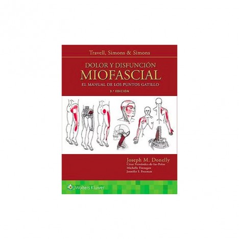 Dolor y Disfunción Miofascial. El Manual de los Puntos Gatillo