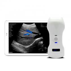 Ecógrafo Inalámbrico Physiotecno Dual Pro 192 + IPAD 64G